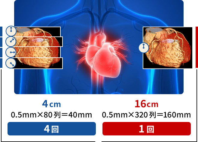 図：320列CTのイメージ図。80列との比較になっている