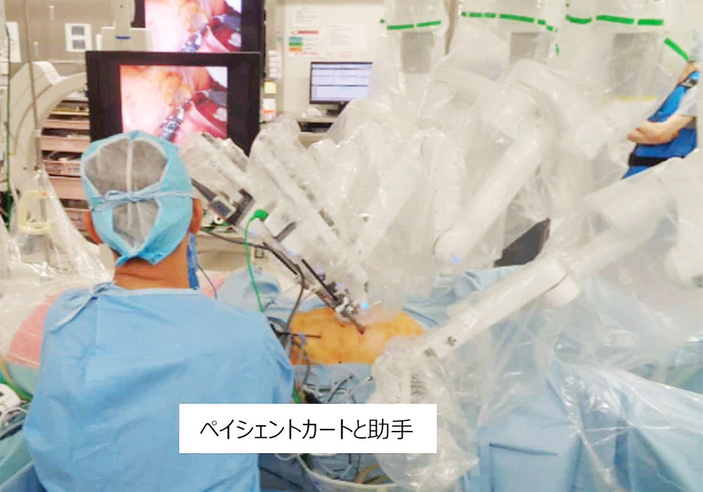 写真：ロボット支援結腸手術の一場面2