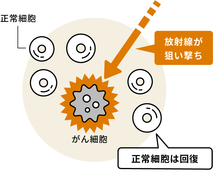 図：放射線治療の仕組みを現した図。放射線ががん細胞を狙い撃ちし、正常細胞は回復する。