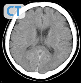 写真：CTの出力画像