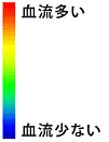 脳血流SPECT−４