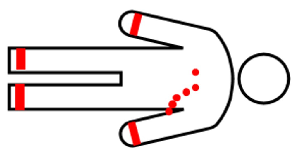 心電図（ECG¹⁾）｜検査ガイド｜患者さん向けガイド｜原三信病院